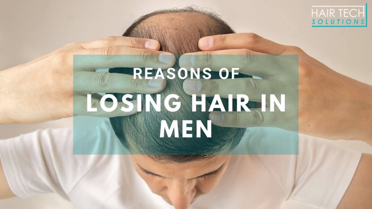 Hair Systems London | Hair Replacement Systems For Men London, UK